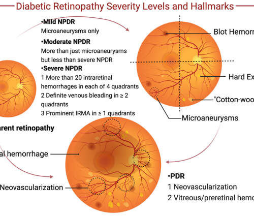 disclose dents lease